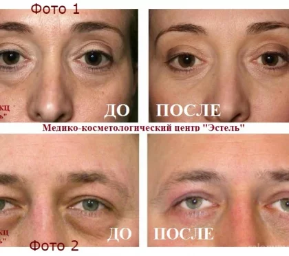 Медико-косметологический центр Эстель 