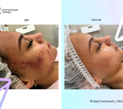 Студия эстетики Хрустальные гвозди фото 2