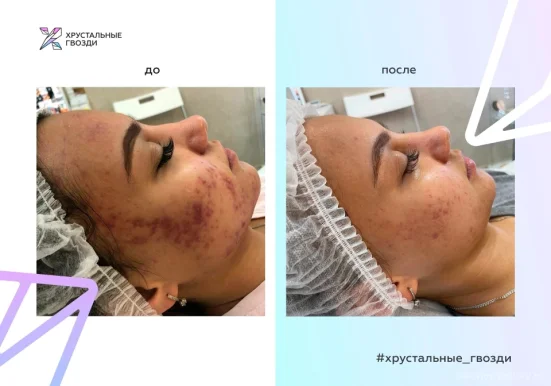 Студия эстетики Хрустальные гвозди фото 2
